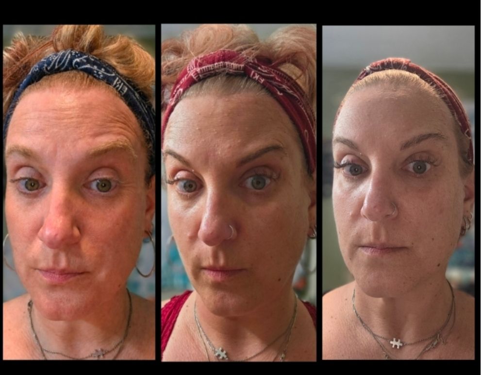 is ghk cu naturally occurring in humans Meet GHK-Cu, the Copper Peptide Taking Over Your Skincare Feed—Here's Whether It's Worth the Hype b12injectable