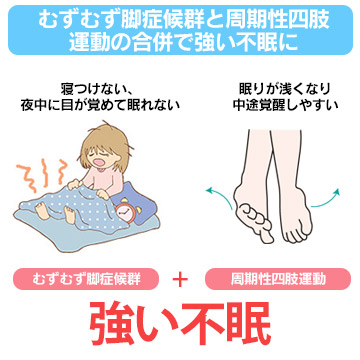 むずむず脚症候群 Explore Facebook