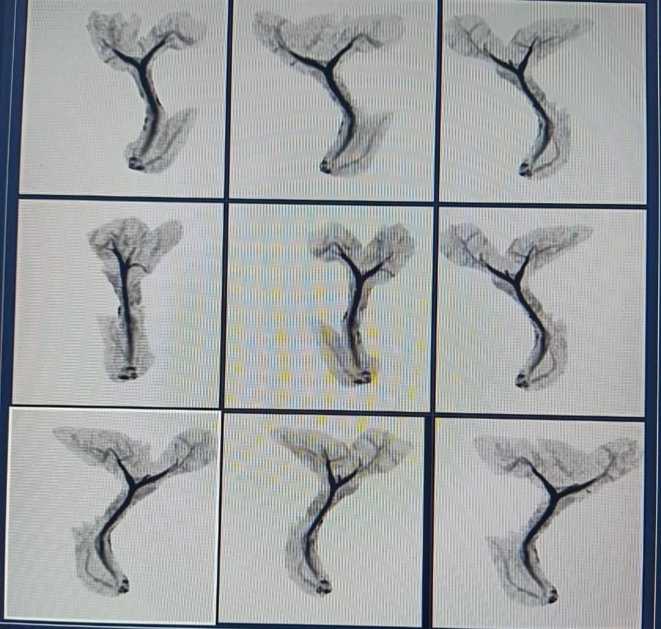 Multan MRI Center performing MRCP on... - Multan M.R.I Centre | Facebook