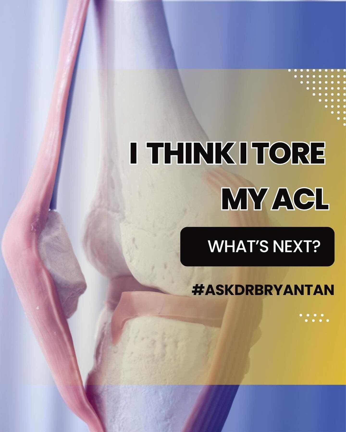 Dr Bryan Tan - An ACL tear is an injury to the anterior... | Facebook