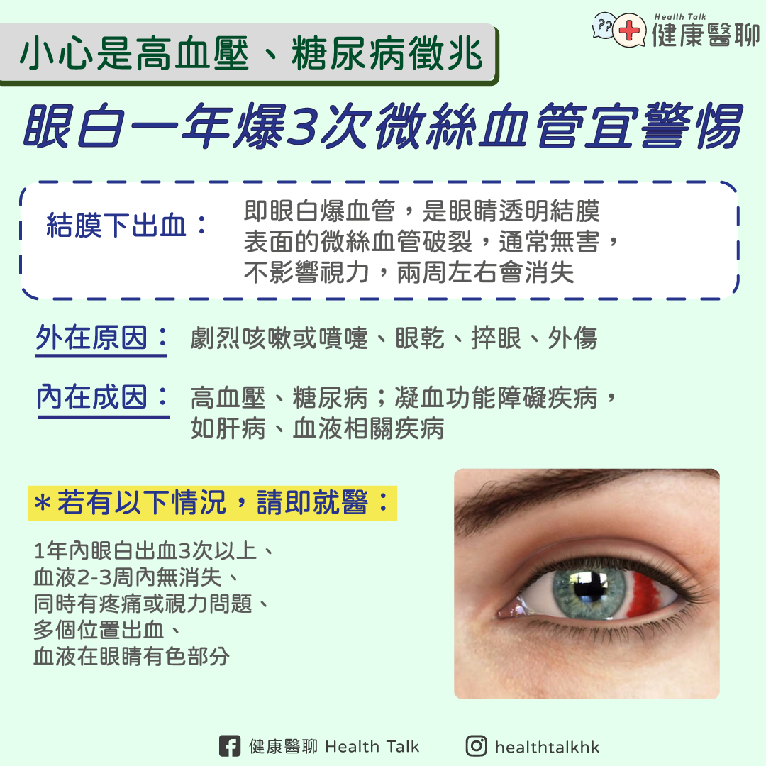 大灣區健康醫聊 GBA Health Talk - 【眼白爆血管 兩周左右會消散】 有無遇到這種情況，忽然感覺眼睛怪怪的，到鏡前抬眼一望，原來 ...