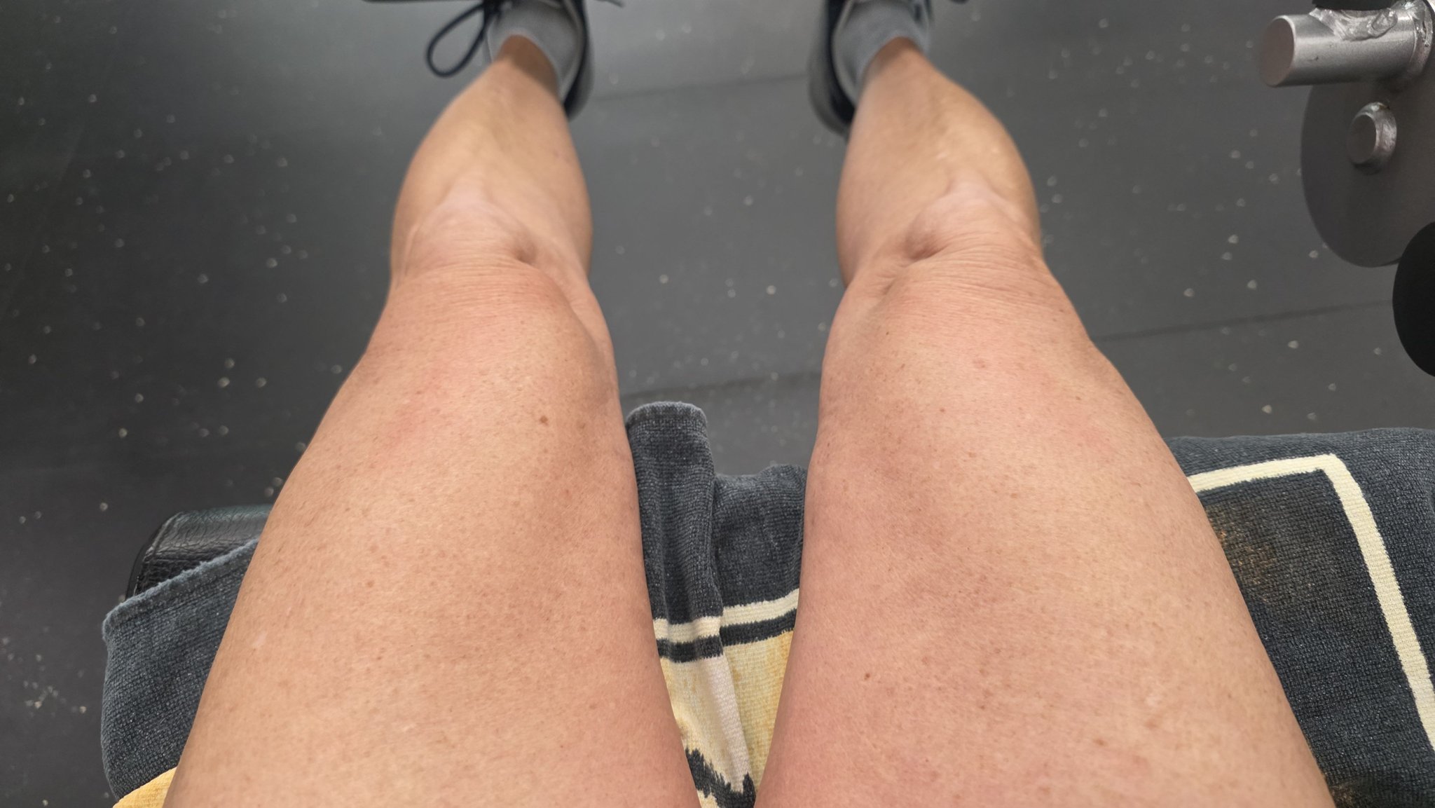 bpc-157 injection site knee Anyone using BPC 157 or TB 500 post surgery injecting near the knee? Quantity based price:For 5-20 boxes TRUSTPILOTSKU|BOOST-002 Mike O'Hearn -Should You