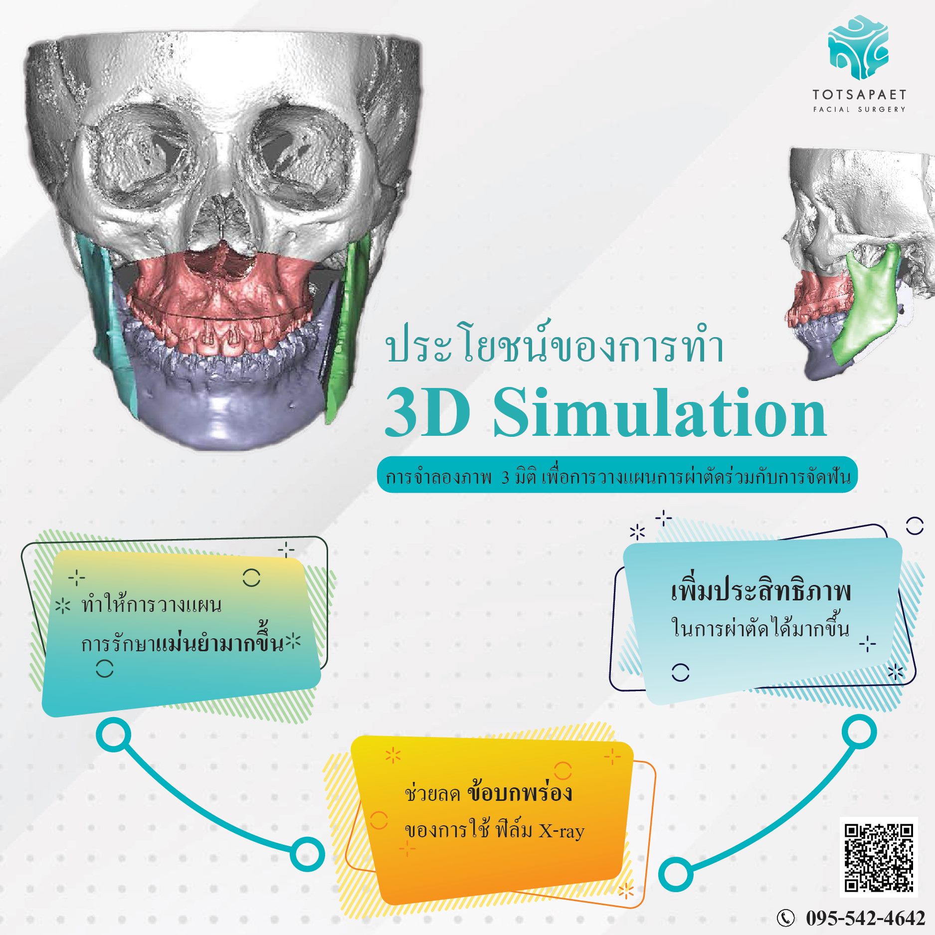 3D Simulation ในเคสที่ทำการผ่าตัดร่วมกับการจัดฟัน สำหรับการทำ 3D ...