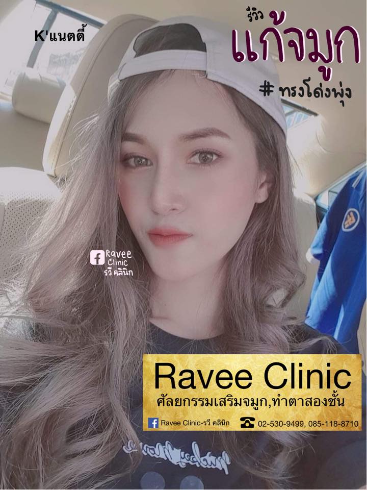 แก้จมูก