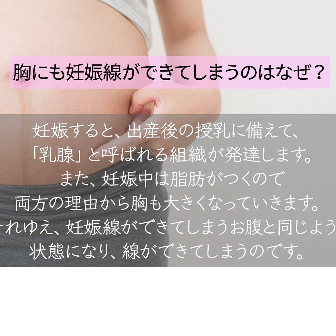妊娠 線 胸