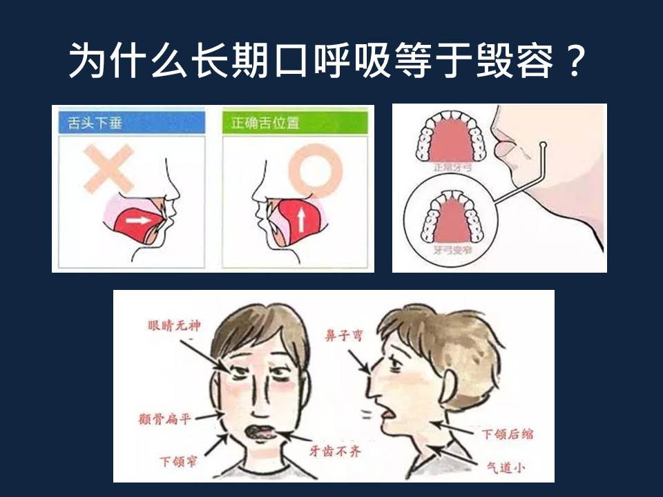 口呼吸为什么会影响颜值 Family Care Dental Batu Pahat 家家牙科 Facebook