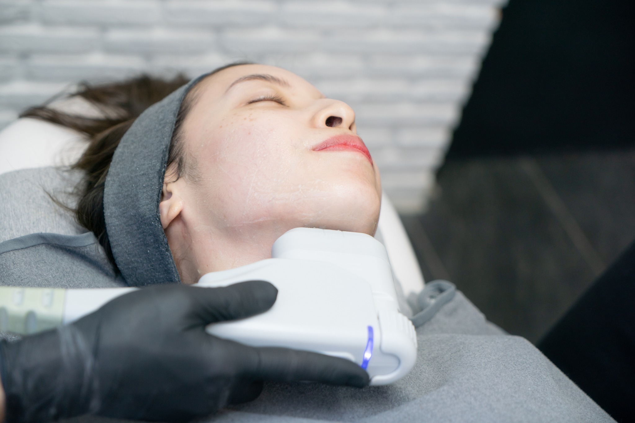 Deva Med Spa | North Vancouver BC