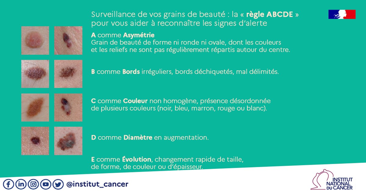 La Peau Mlanome De La Peau Institut National Du Cancer Cancer De La