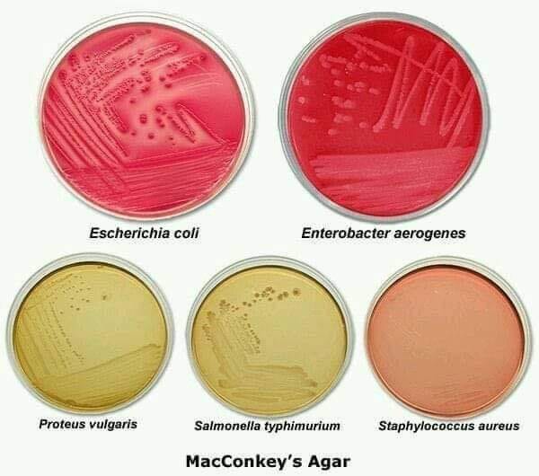 Avizeet Halder - 💛 MacConkey Agar 💛 MacConkey agar is... | Facebook
