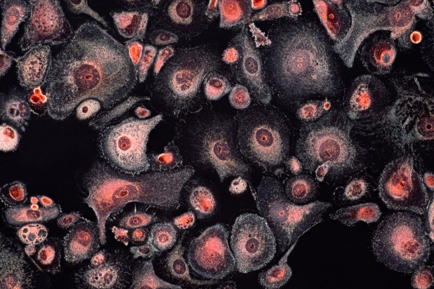 Microplanet
