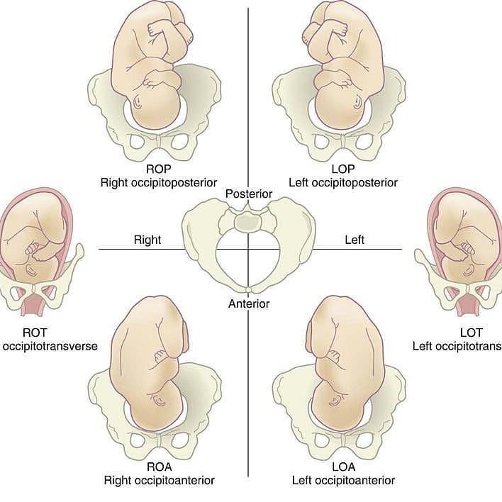 BirthSense - Such a useful diagram on the variations in fetal ...