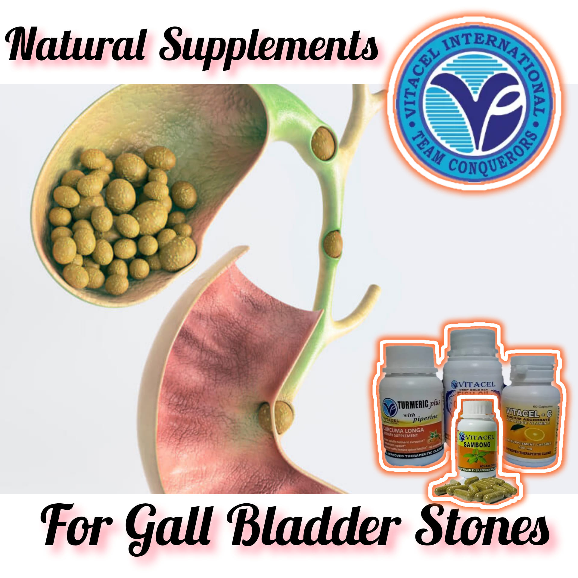 What vitamins can help with gallstones?