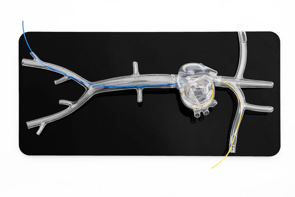 Angiogram Sam