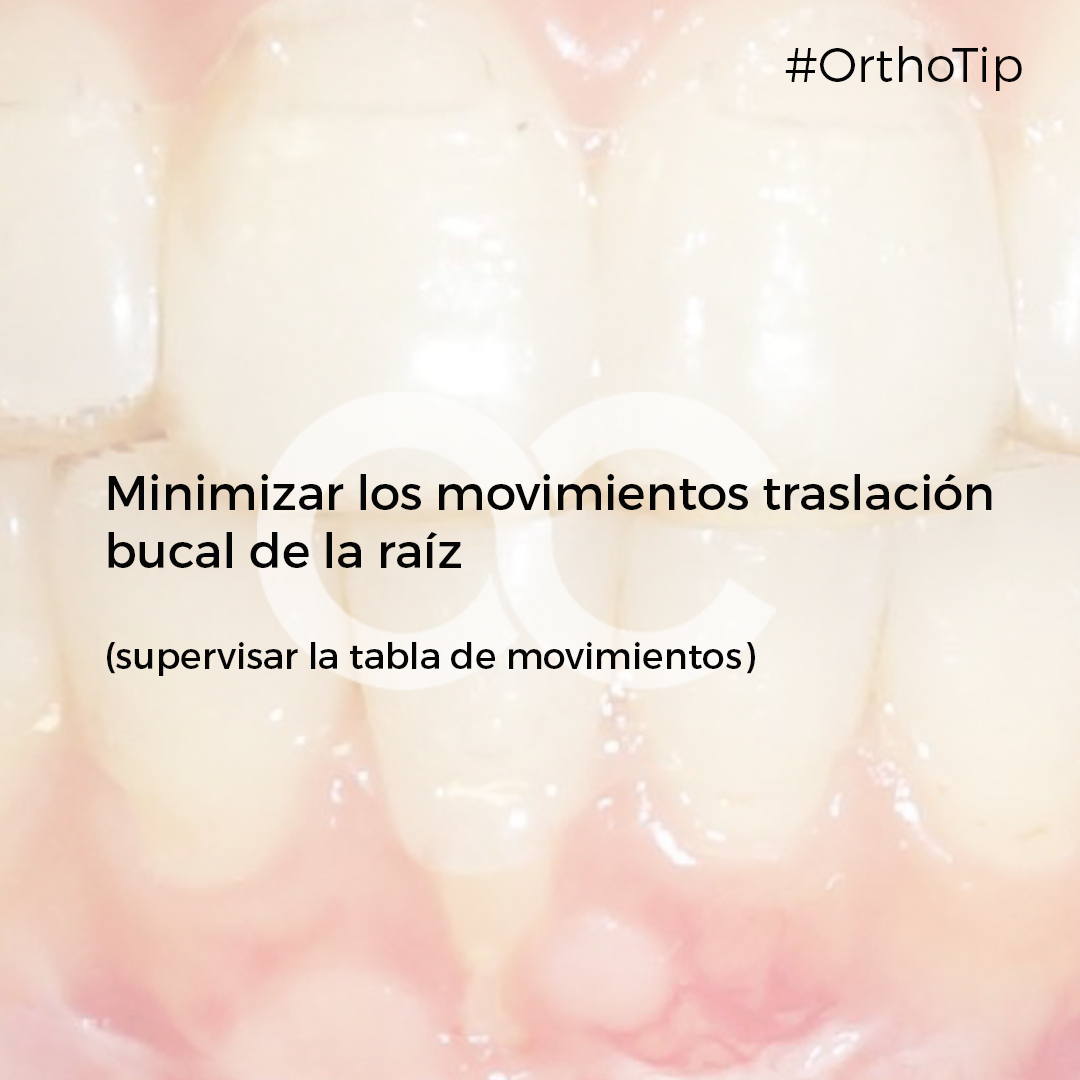 🔺RECESIONES Y ALINEADORES🔻 Muchos... - OrthoClub Academy