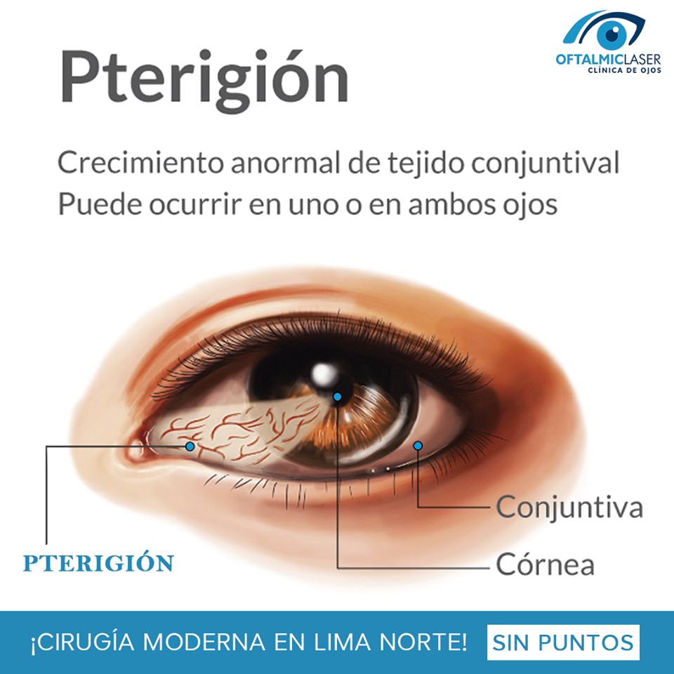 En Clinica de Ojos... - Clínica de Ojos Oftalmic Laser