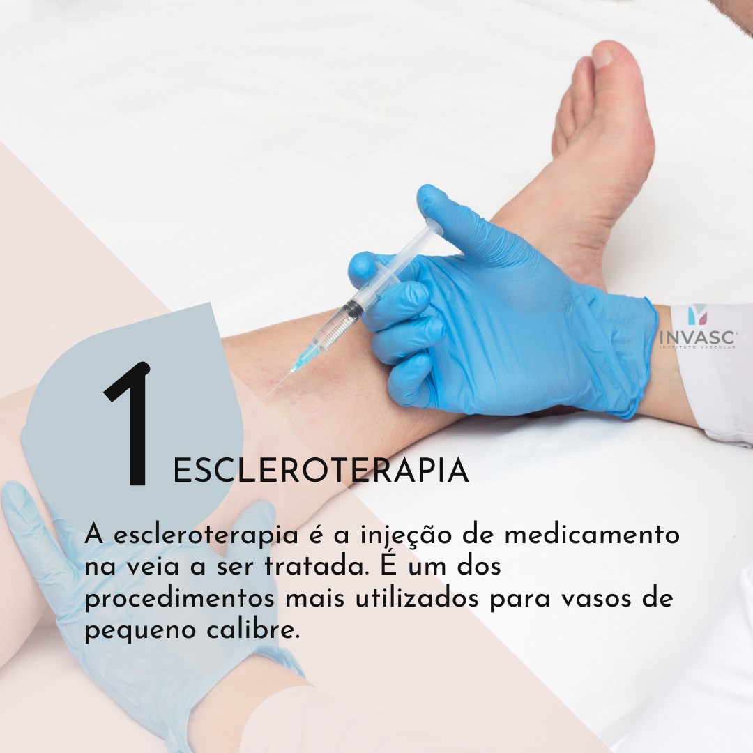 ☝️ 3 tipos de tratamento... - Invasc - Instituto Vascular | Facebook