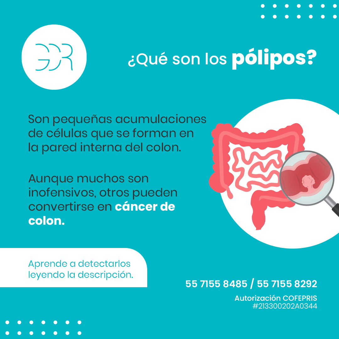 Doctor Guillermo Colín Rojas - Los pólipos pueden detectarse de manera ...