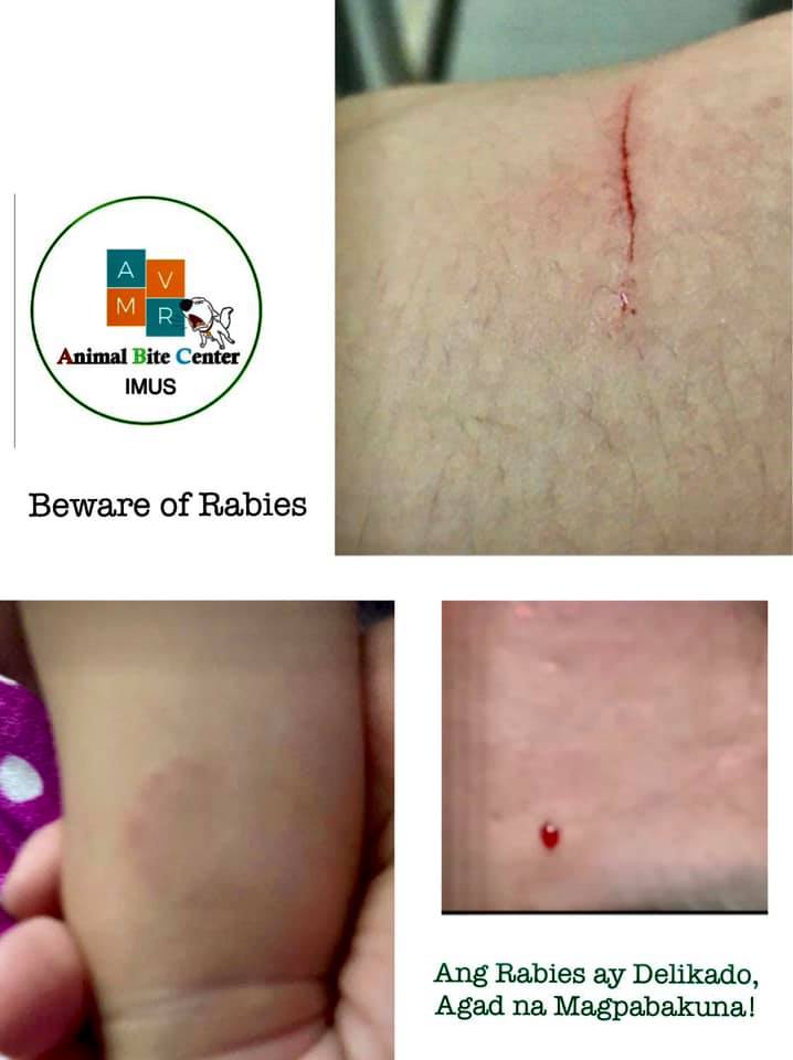AVMR Animal Bite Center - Imus Branch - Ang rabies ay delikado. Kaya ...