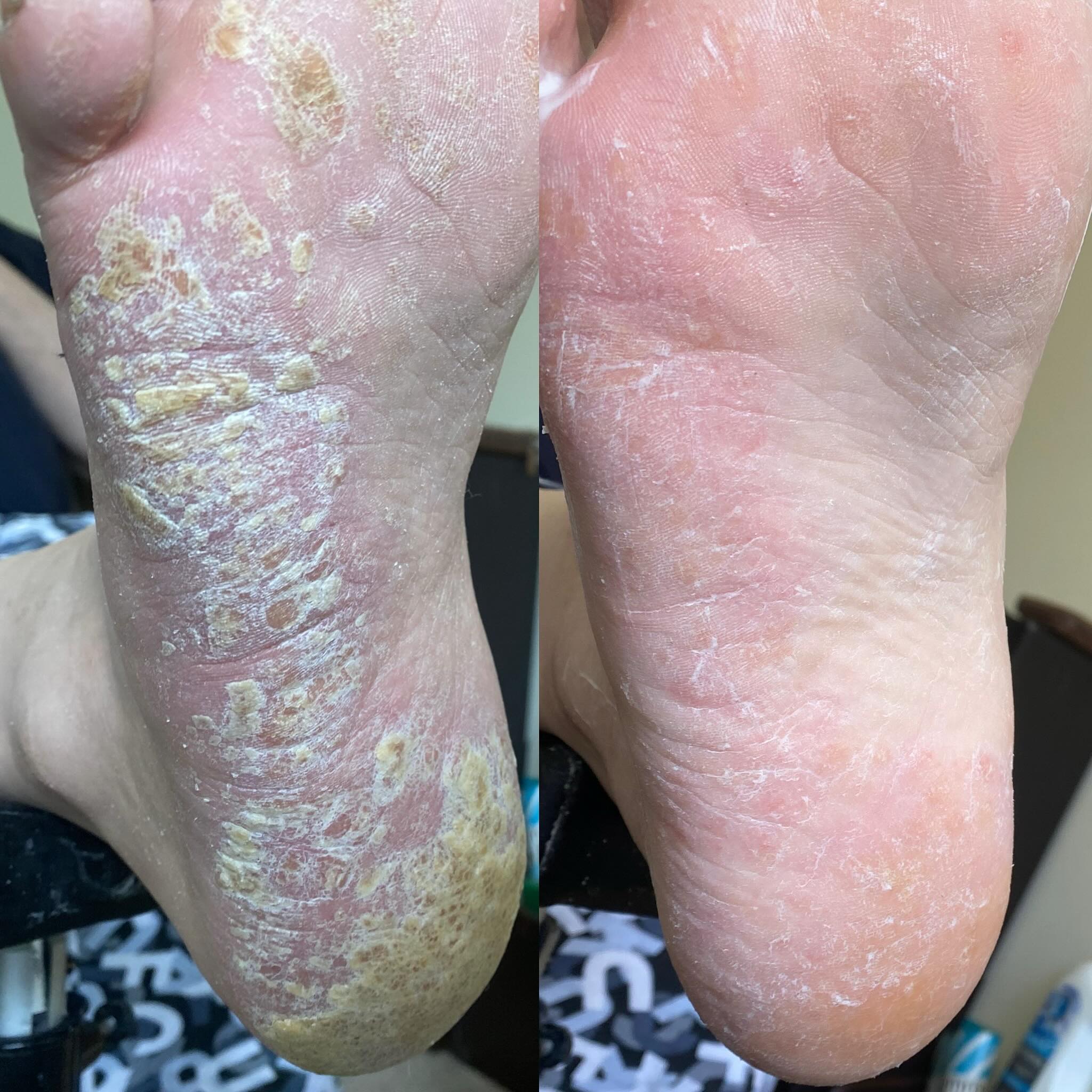 Step Forward - Grace's Mobile Foot Health Clinic | Nottingham