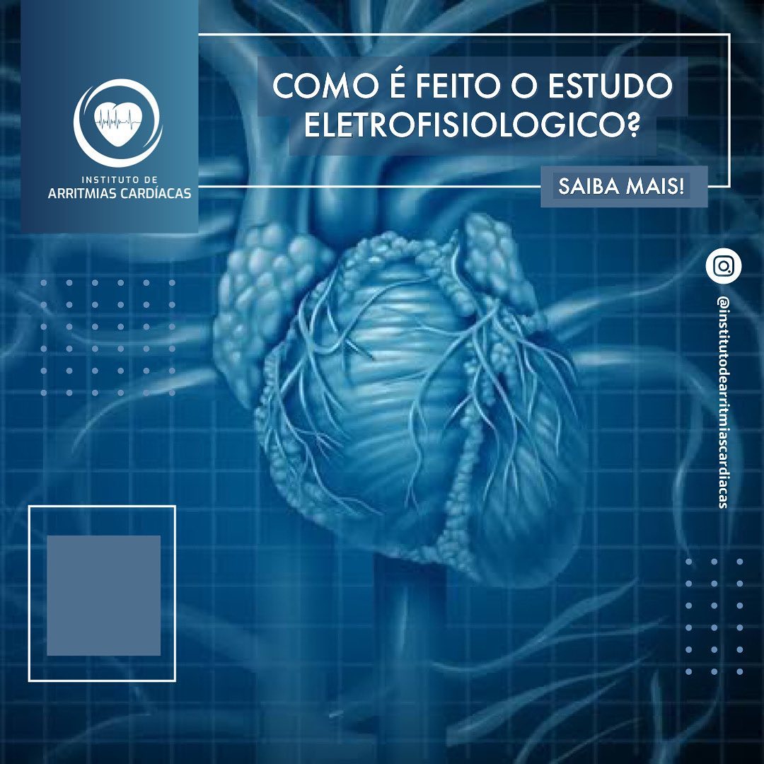 Instituto de Arritmias Cardíacas - O estudo fisiológico é um exame ...