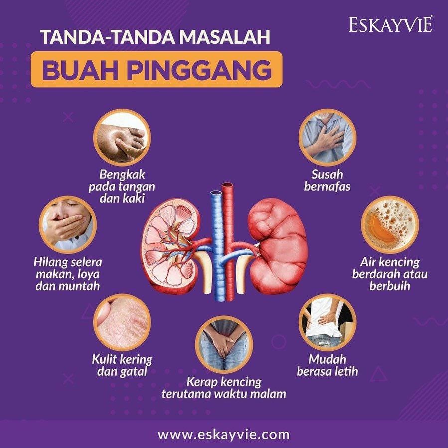 Reverse - Tanda2 Masalah Buah Pinggang 🥺 . Kebiasaannya, tanda-tanda ...
