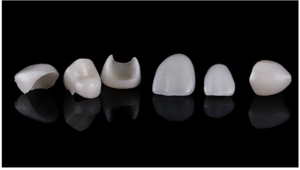 Ricafort Dental | San Miguel