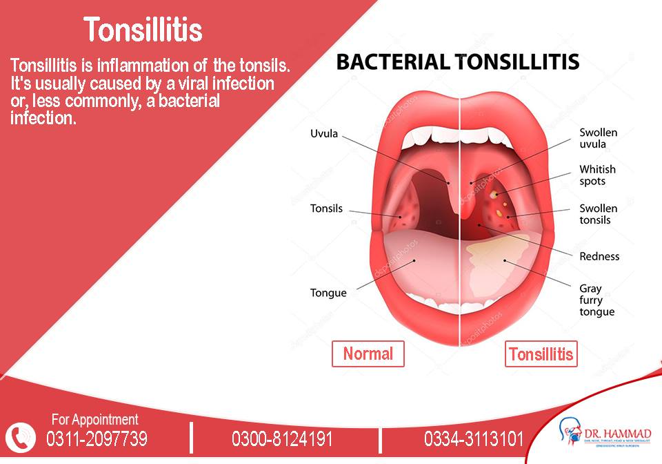 Common signs... - Dr. Hammad - ENT, Head & Neck Specialist