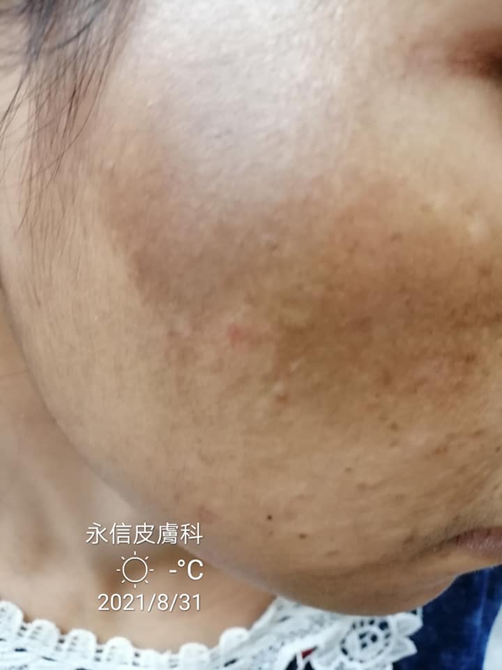 永信皮膚科診所 Home Facebook