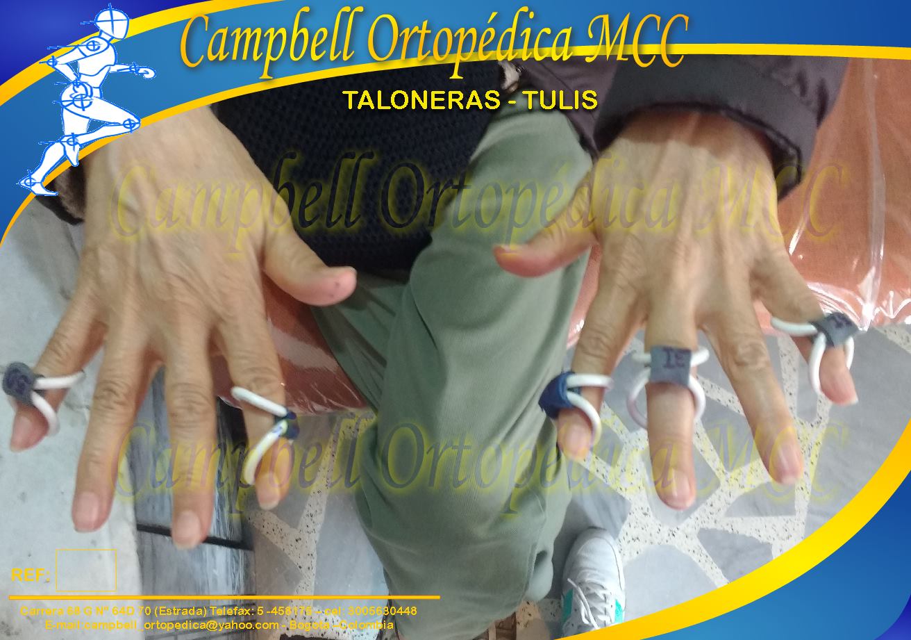 Campbell Ortopédica MCC - CAMPBELL ORTOPÉDICA MCC. Férula o Anillo en 8 ...