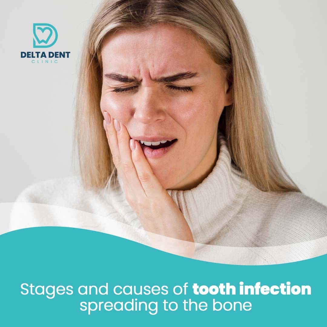 Delta - Let's talk about the stages and causes of tooth infection ...