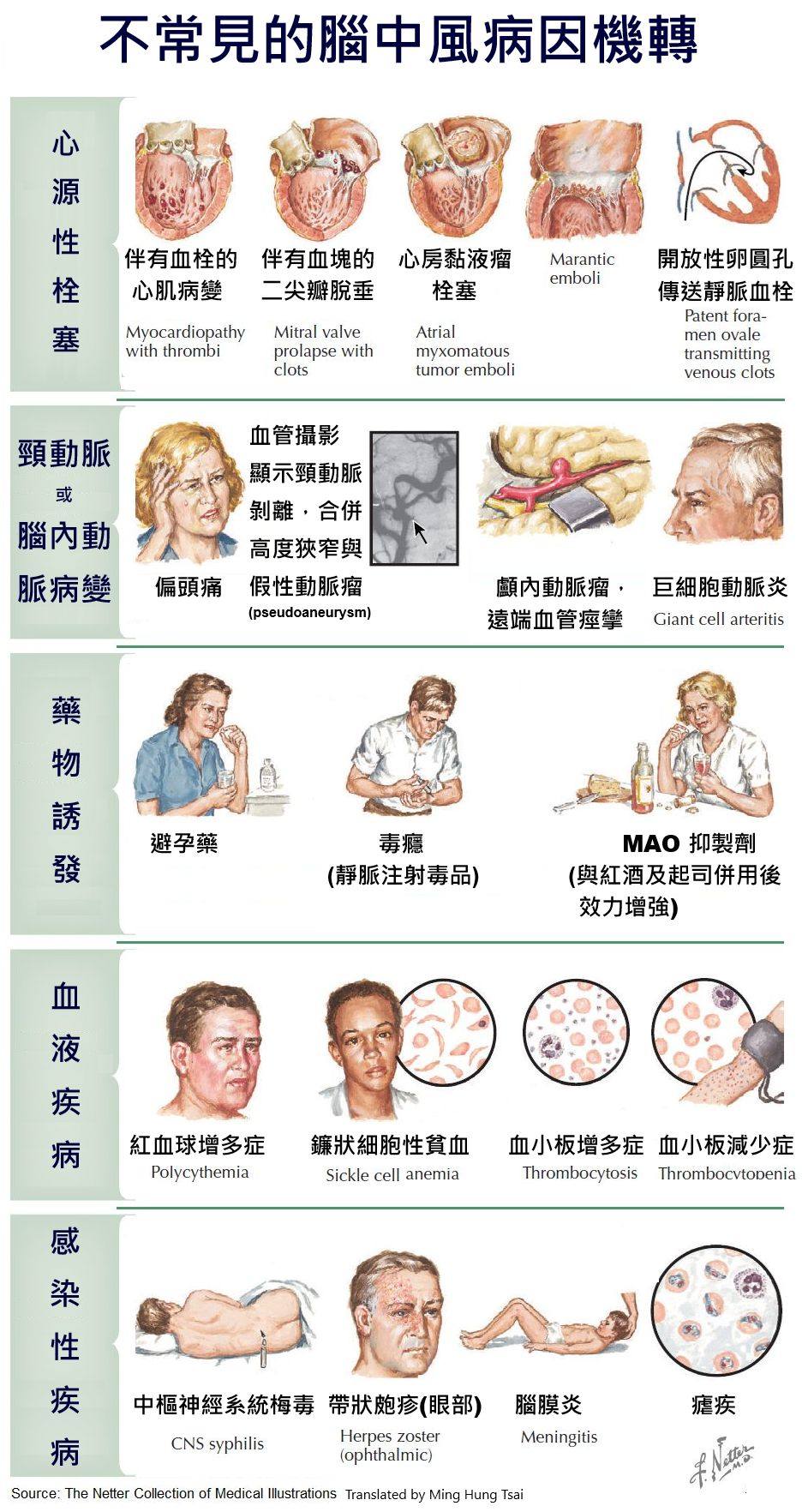 臨床筆記社團 | # 🛜**不常見的腦中風病因機轉 (Uncommon Etiologic Mechanisms in Stroke ...