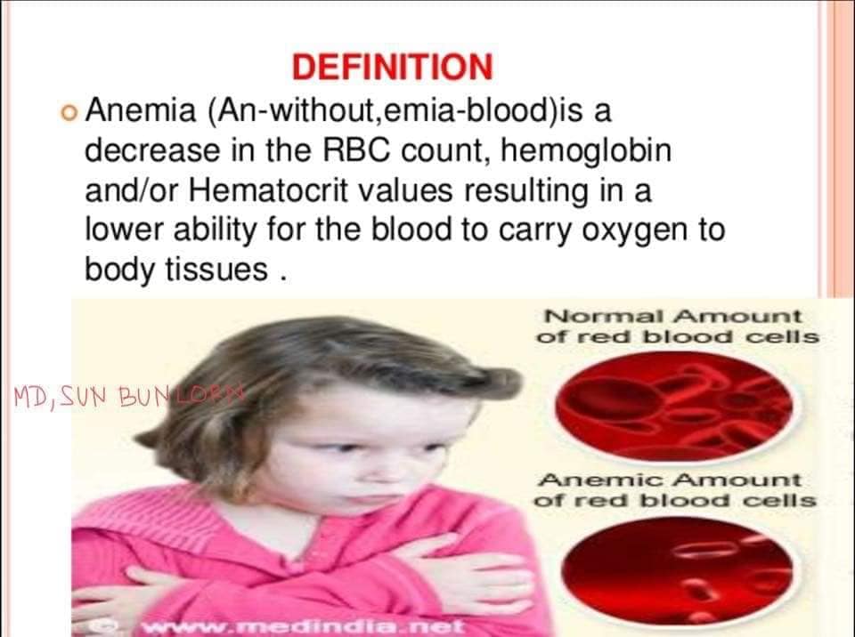 Anemia Definition Cause Sign And Zayed Health Center Facebook