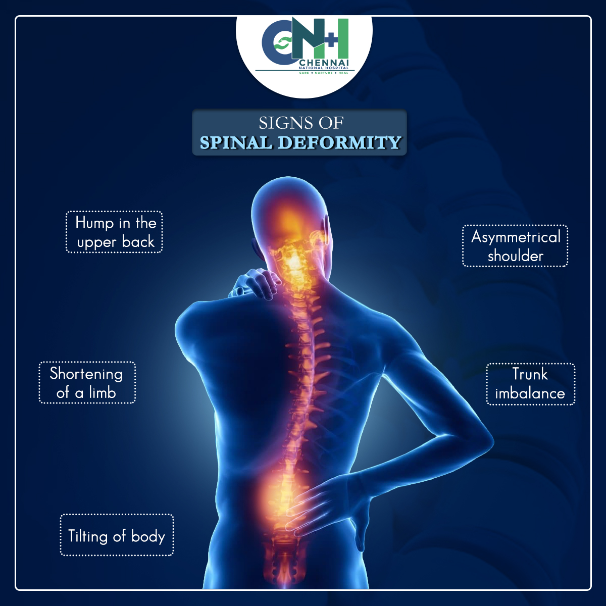 The most common type of spinal... - Chennai National Hospital