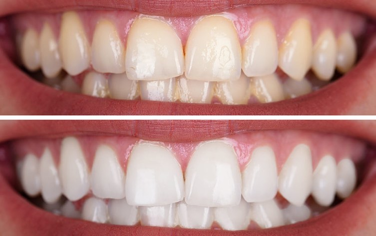 Modern Smiles Family Dentistry | Phoenix AZ
