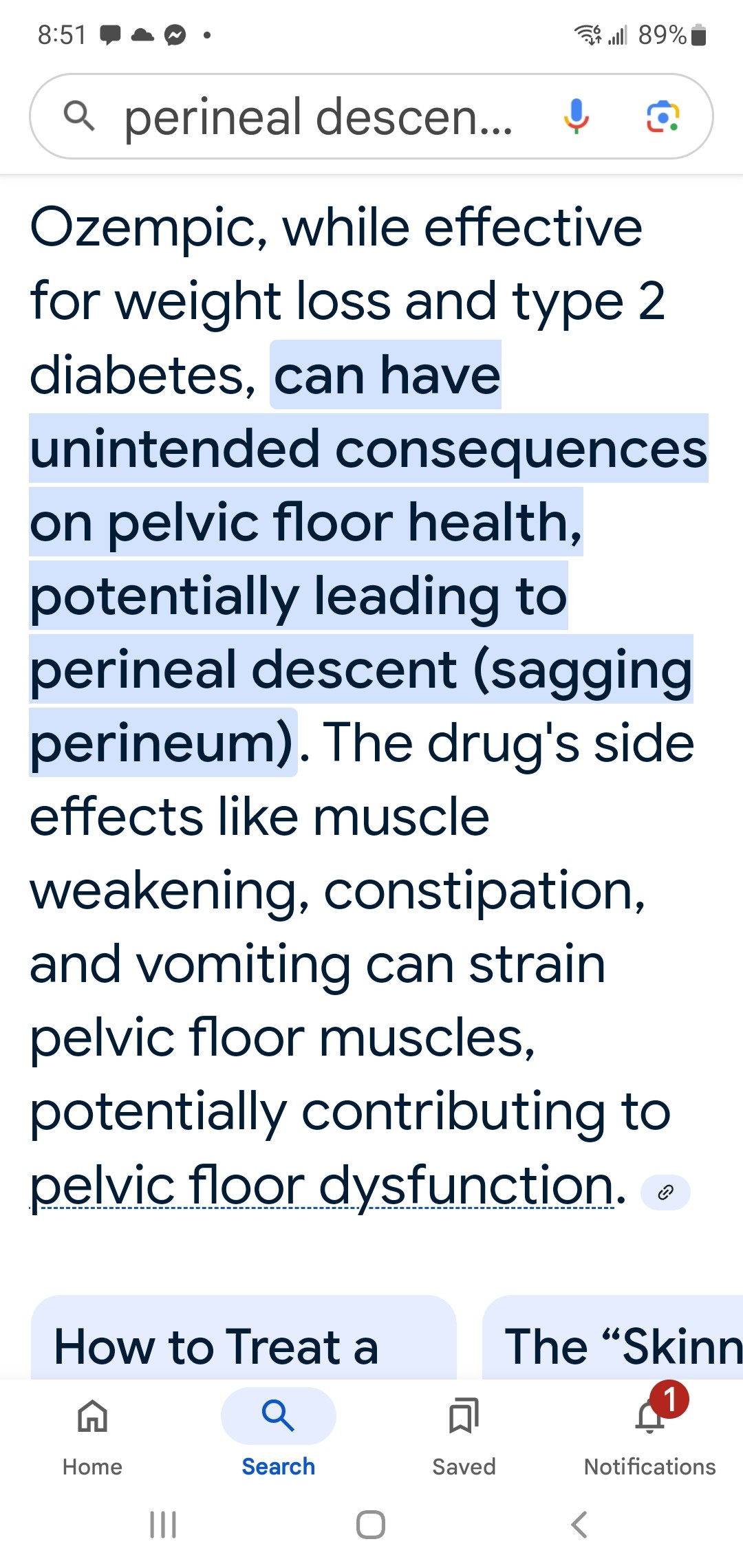 Does GLP-1 affect POTS symptoms?