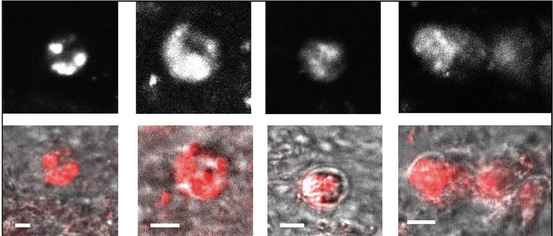 ICIPE - A newly discovered microbe that blocks transmission of #malaria ...