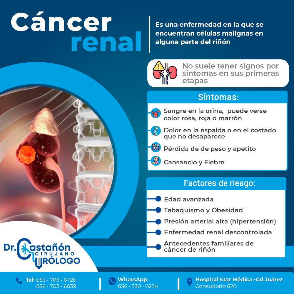 Dr. - 👨🏻‍⚕️ El cáncer renal es un tipo de cáncer que comienza en los ...