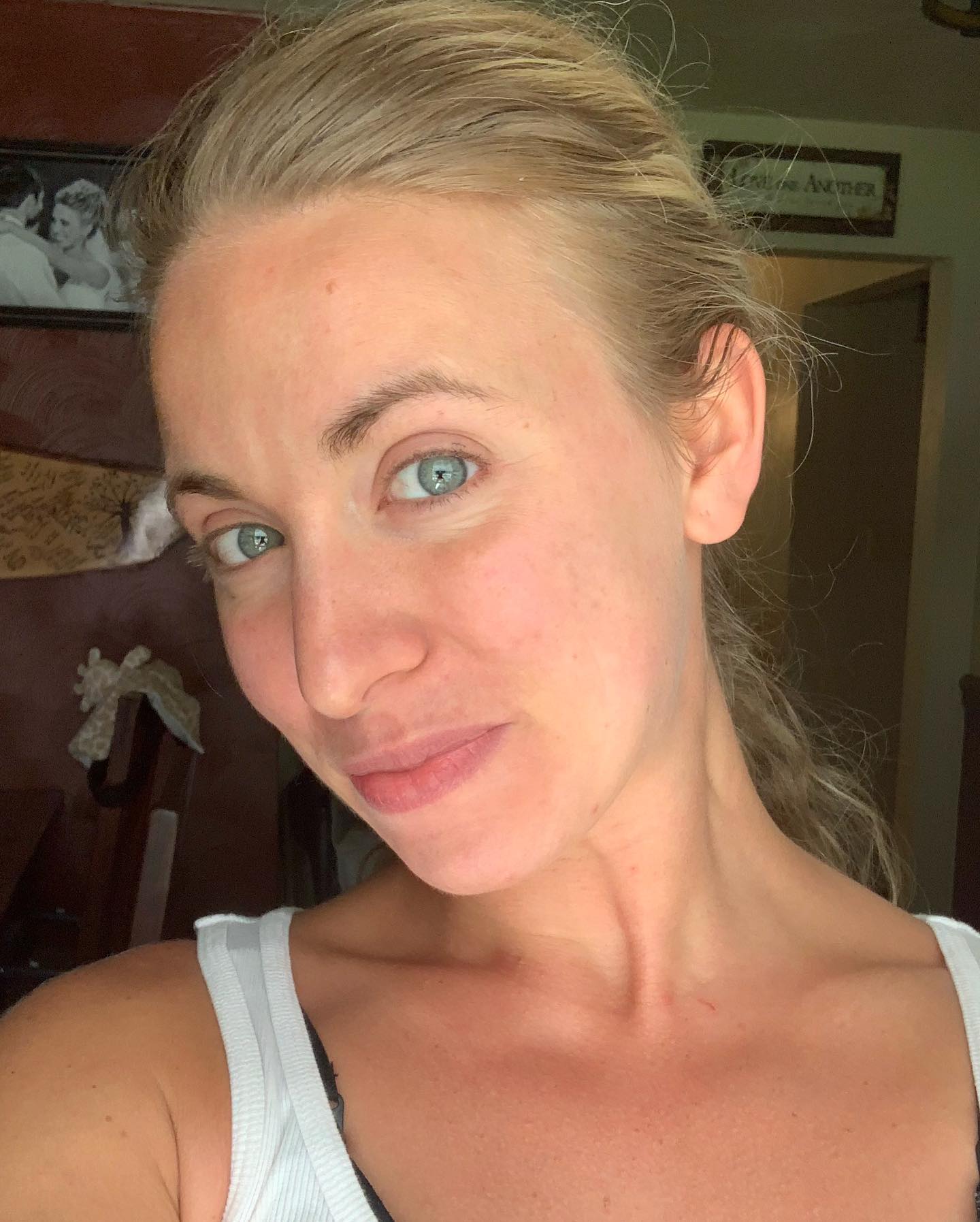 does klow help with acne I have chronic cystic acne. It's been my skin cross to bare. Embarrassing & painful breakouts to the point where my skin is falling off. At times, a full time job tending ghk-cu immunogenicity immune response Size:4 BrighteningCare