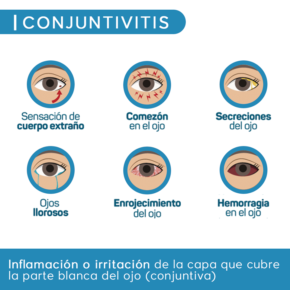 La conjuntivitis es la... - Clínica de Ojos Oftalmic Laser