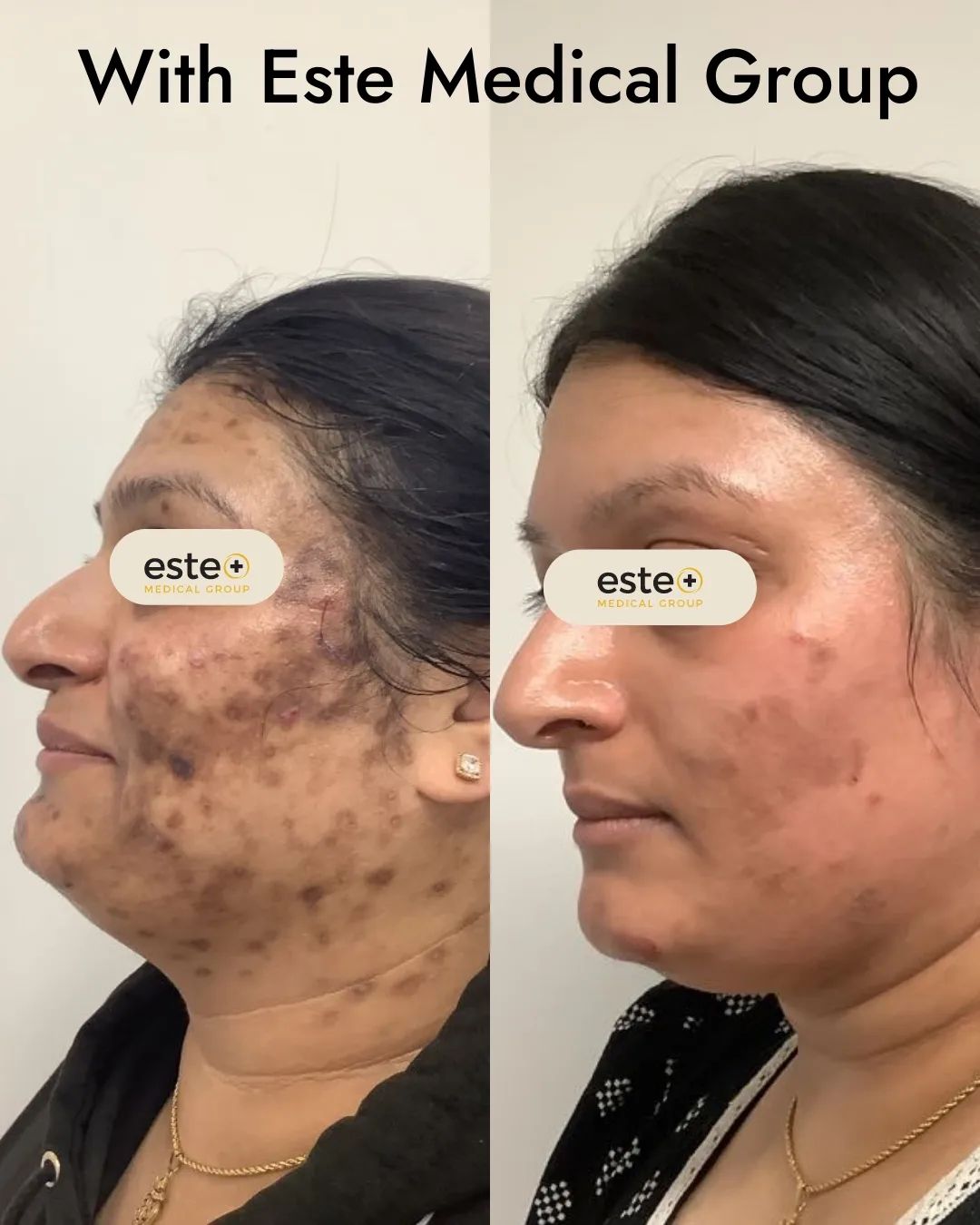 Este Medical Group