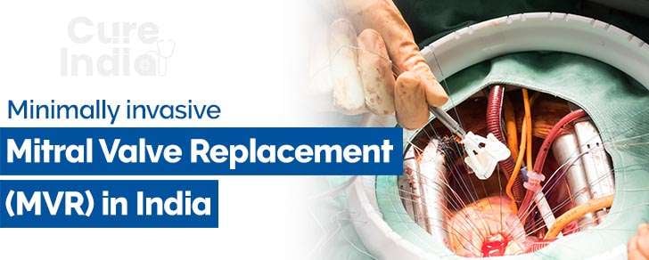 Mitral valve surgery is... - CureIndia-Treatment in India | Facebook