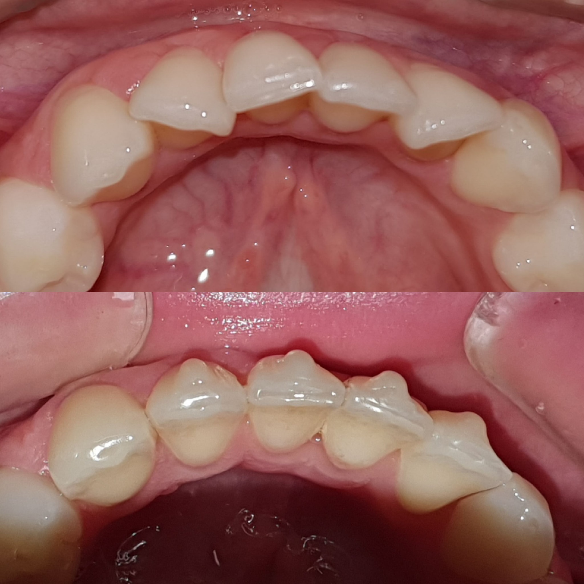 Ortho digitaline - Affidati al Made in italy per allineare i sorrisi ...