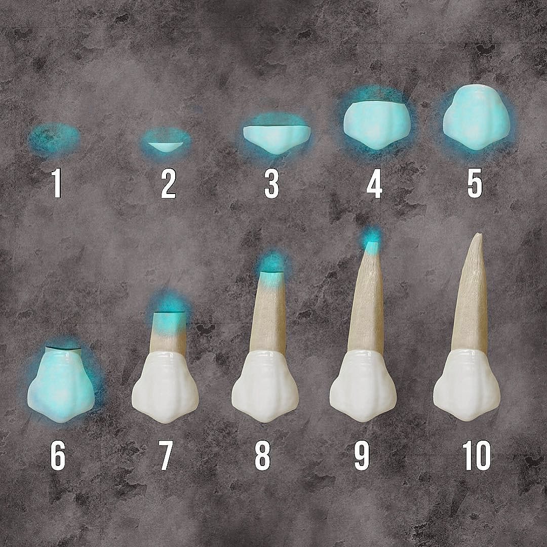 Nolla’s Stages Of Tooth Development... - Dentistsnearby.com | Facebook
