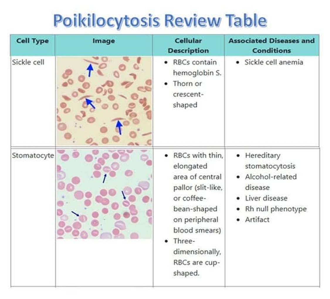 Medical laboratory technician | 🌹 Summary of Red Blood Cell (RBC ...