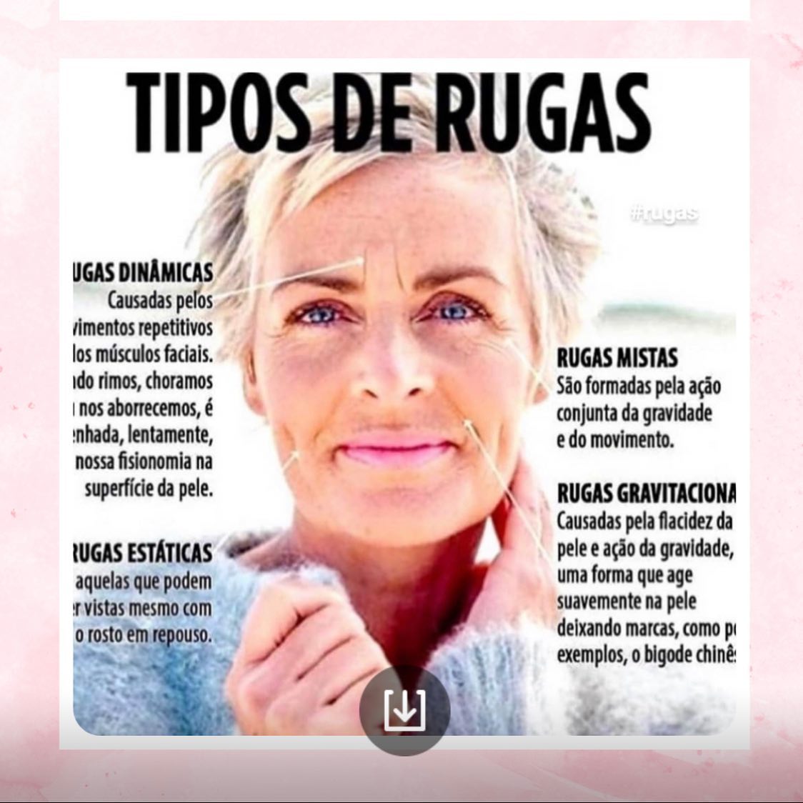 Tipos de Rugas Faciais: 👉🏻RUGAS... - Luciane Hyppolito | Facebook