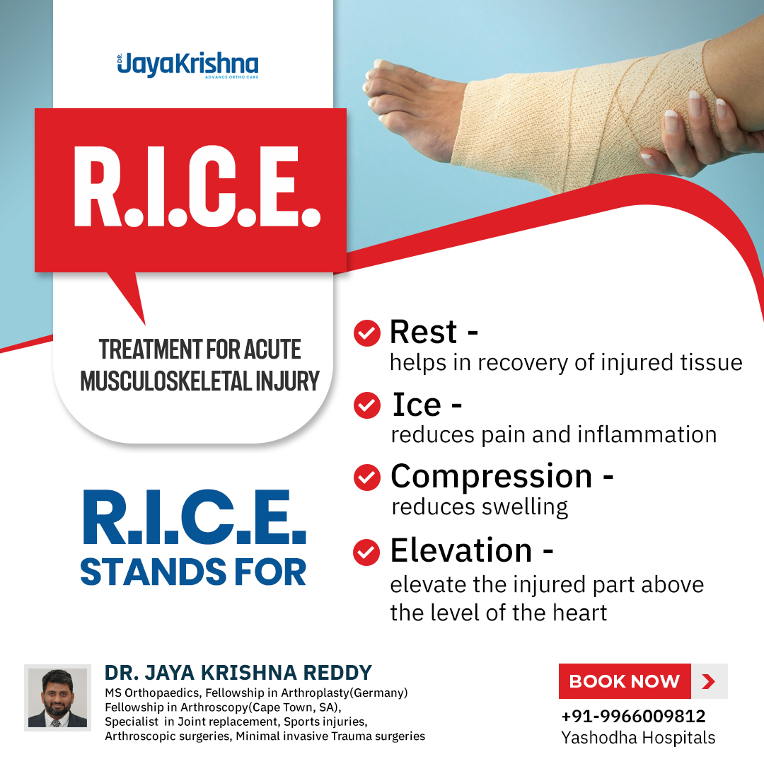 Dr.Jaya - RICE is a method of self-care that can be used when you ...