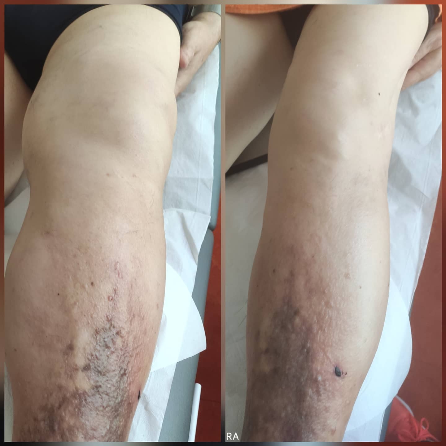 Titaniums!! Despedimos la semana con... - Clinica Titanium | Facebook