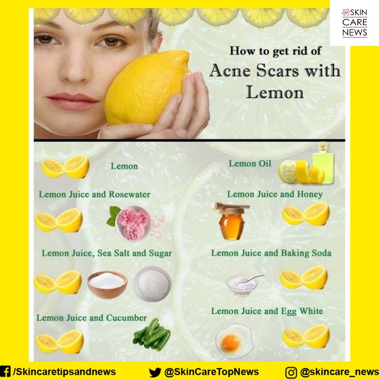 View of Acne Scars Before And After Lemon