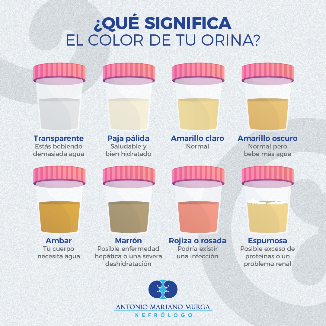 🕵 El color de la orina puede... - Dr. Mariano Nefrólogo | Facebook
