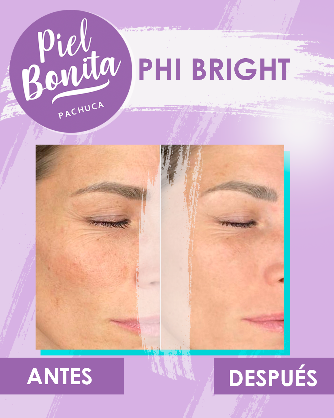 💜 ¿QUÉ ES PHI BRIGHT? 💜 Es una... - Piel Bonita Pachuca